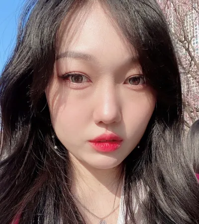 [目] Sally - 目の下の脂肪再配置