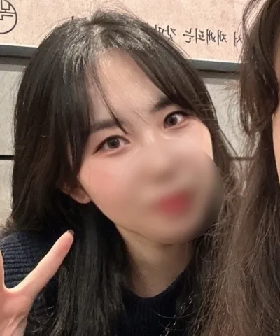 [目] オチョチョ - 切開二重再手術