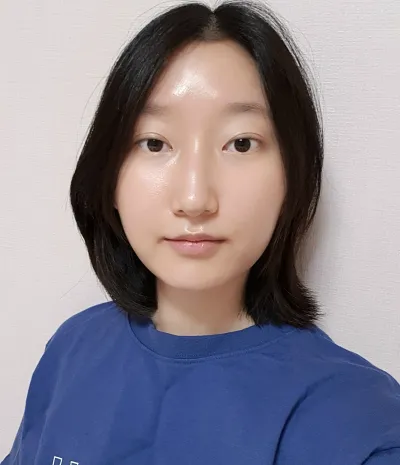 [目] 卵焼き - 切開式眼瞼下垂修正再手術、グラマラスライン