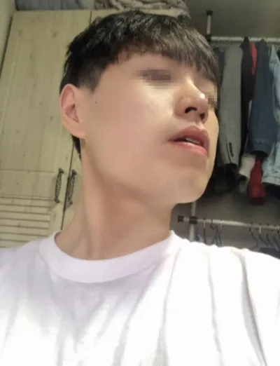 [輪郭手術] コーズ802 - エラ、顎先、鼻筋