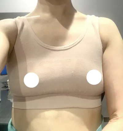 [豊胸] オクスニ - 胸