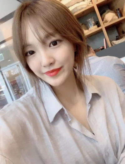 [目] 整形レビュー - 目つき矯正