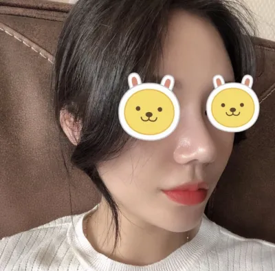 [鼻] 亀の甲羅のような鼻 - 鼻