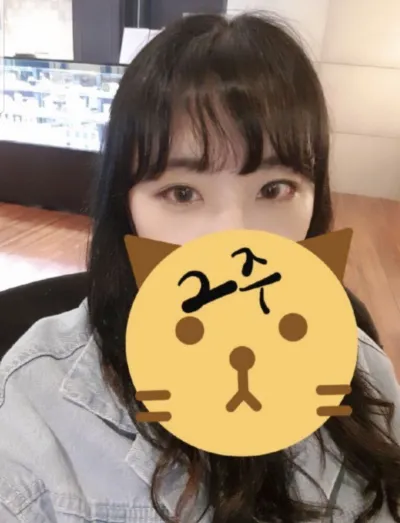 [目] shshin7 - 目尻切開、グラマラスライン