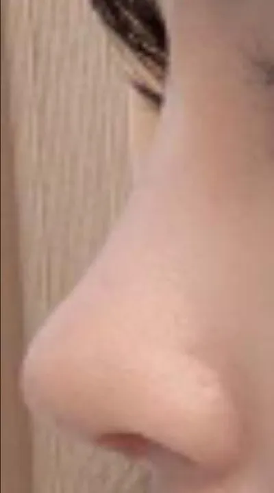 [鼻] ヤバンチュ - 鼻