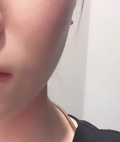 [皮膚] sang13 - シュリンク