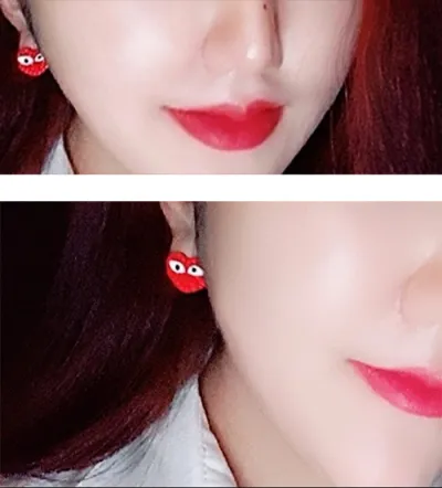 [쁘띠] アルロダルロク牛乳 - フィラー、ボトックス、輪郭注射