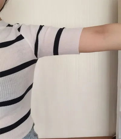 [脂肪吸引] カルー - 脂肪吸引