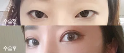 [目]ウンミカミ - 目