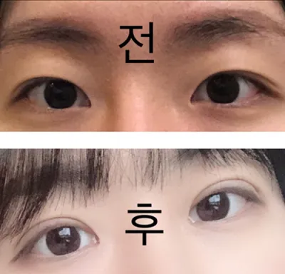 [目] ヨウギャンソプ - 目