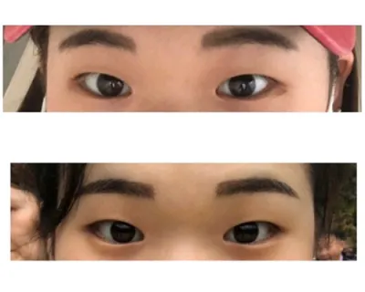 [目] ジバンバ - 目