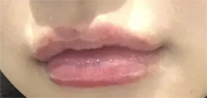 [プチ] ムハニ - 唇