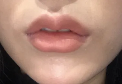 [プチ] lil887 - 唇