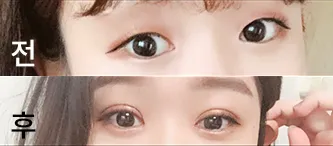 [目] シュープイン - 目