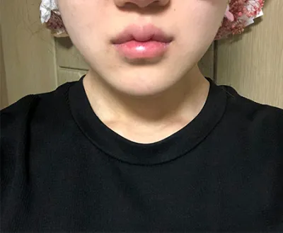 [皮膚] ピョンギュン - シュリンク