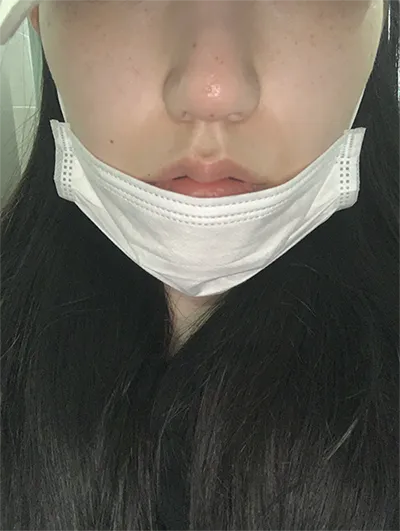 [쁘띠] 햇빛55 - 鼻