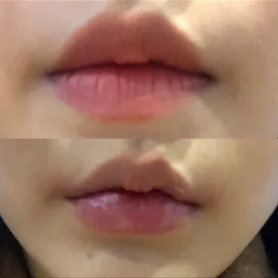 [쁘띠] 찌닝니니 - 唇