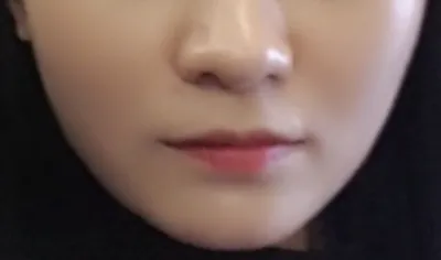 [쁘띠] スビニts - 唇フィラー