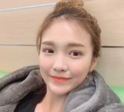 [目] 整形体験 - 目