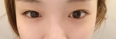 [目] 青いクマ - 目