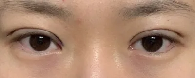 [目] キュルルック - 目