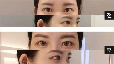 [目] ニッコイ - 目