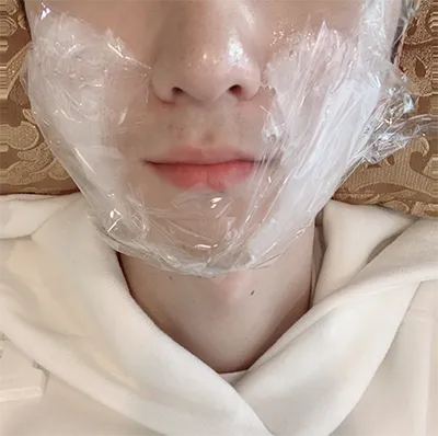 [皮膚] 王밤빵단팥빵 - シュリンク、輪郭注射