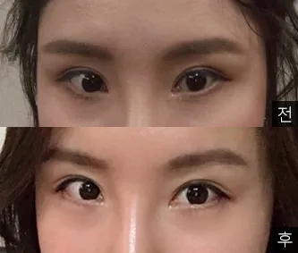 [目] ライライライ - 目