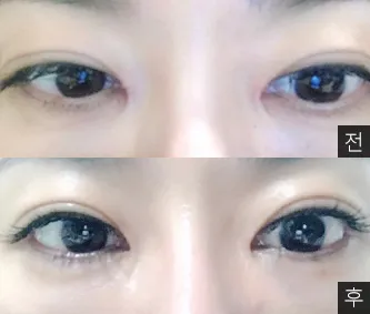 [目] コカコキョ - 目