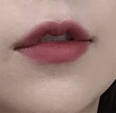 [プチ] amy13 - 唇フィラー