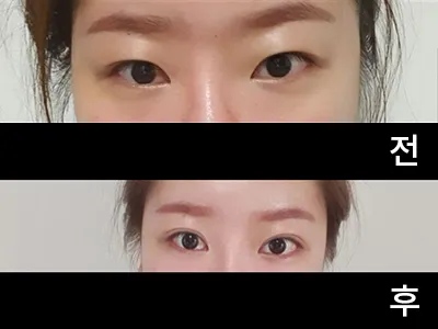 [目] チャン・ミナ - 目