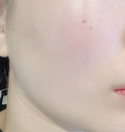 [皮膚] ショットキトック - シュリンク