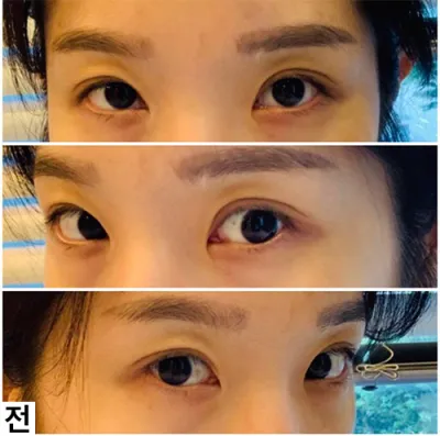 [目] タタンブリ - 目