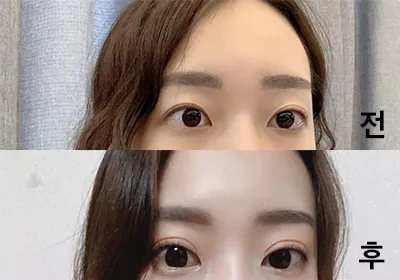 [目] ski03078 - 目