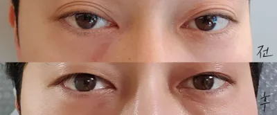 [目] 弾力のある可愛らしさ - 目