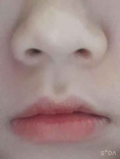 [プチ] ds0405 - ボトックス