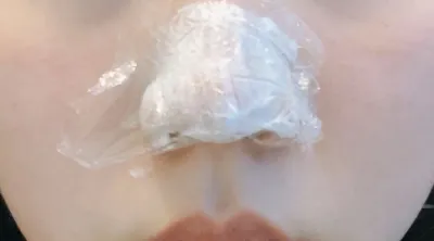 [プチ] プリュリ - ボトックス、鼻先