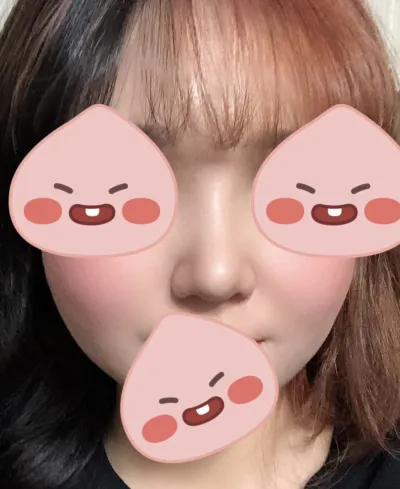 [鼻] ミュナナン - 鼻