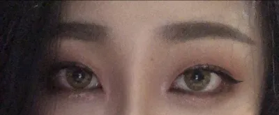 [目] ハイフイヌ - 垂れ目形成、目尻切開