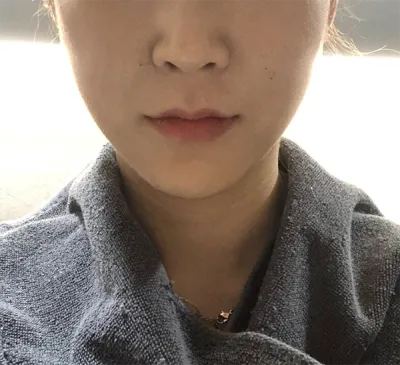 [皮膚] kkkkyu - ウルセラ