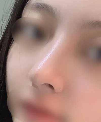 [鼻] 쥬비0111 - 鼻