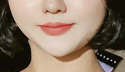 [プチ] ダニリューン - 輪郭注射、顎ボトックス