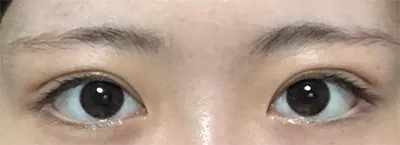 [目] クォン・ドンハ - 目