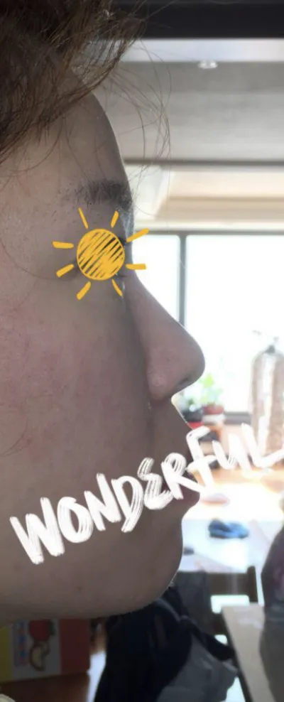 [鼻] Shee288 - 鼻筋、鼻先