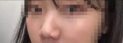 [鼻] どうして電話に出ないの - 鼻