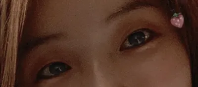 [目] ハババハ - 目つき矯正、切開