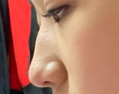 [鼻] だんご鼻 - 鼻 (シリコン)