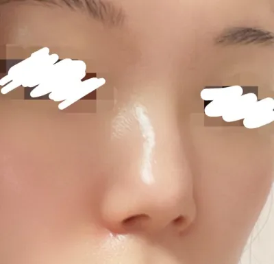 [鼻] ヨムイ쓰 - 鼻