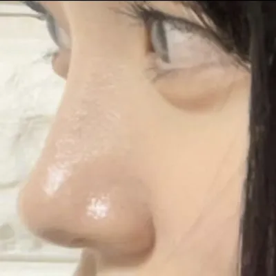 [鼻] トトイ1 - 鼻