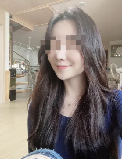 [輪郭手術] singga - 頬骨、顎先